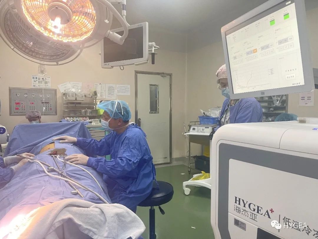 The first case in Zhejiang! Co-Ablation System successfully completed the treatment of multiple hapatic metastases!